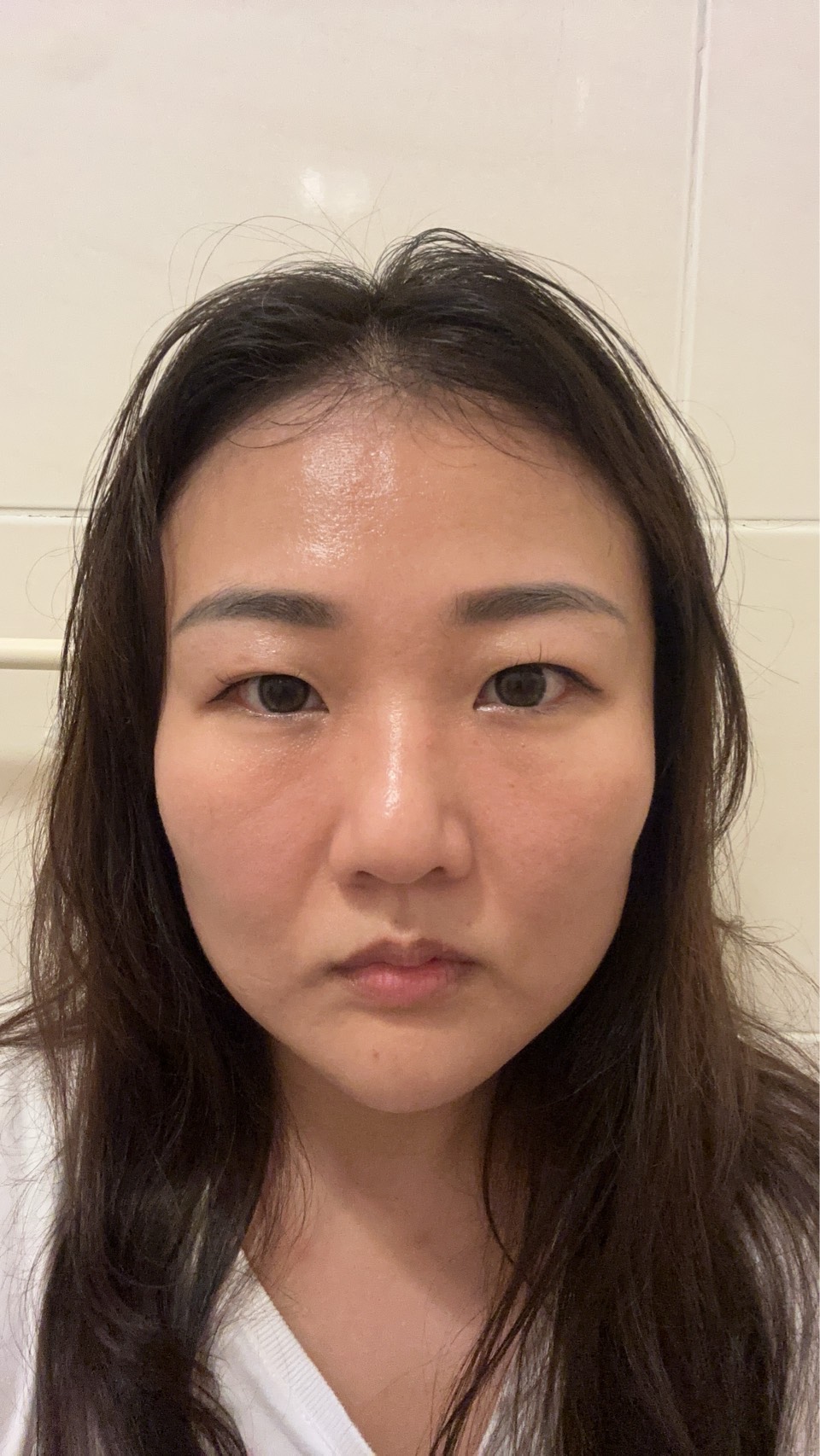 小V臉後