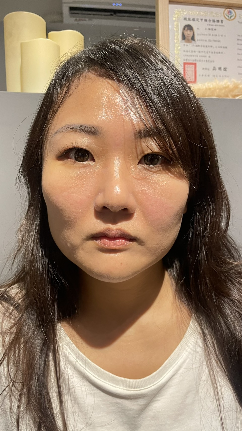小V臉前